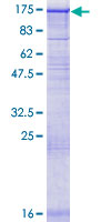 12.5% SDS-PAGE Stained with Coomassie Blue.